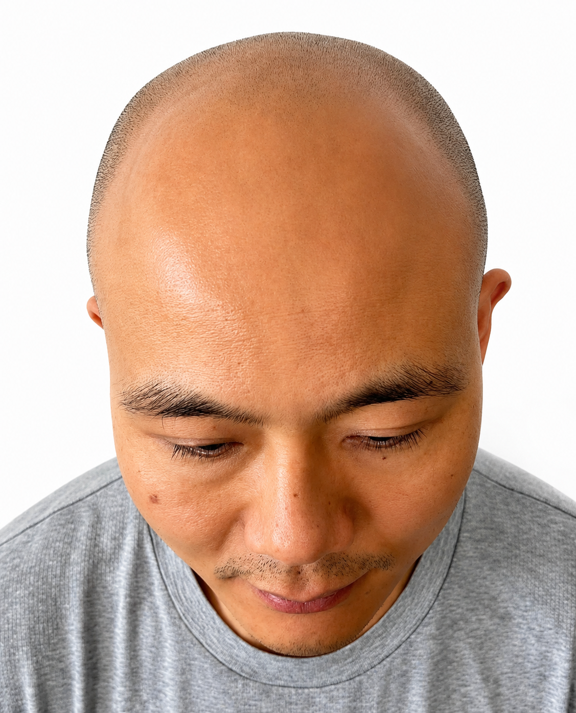 Male crown density
