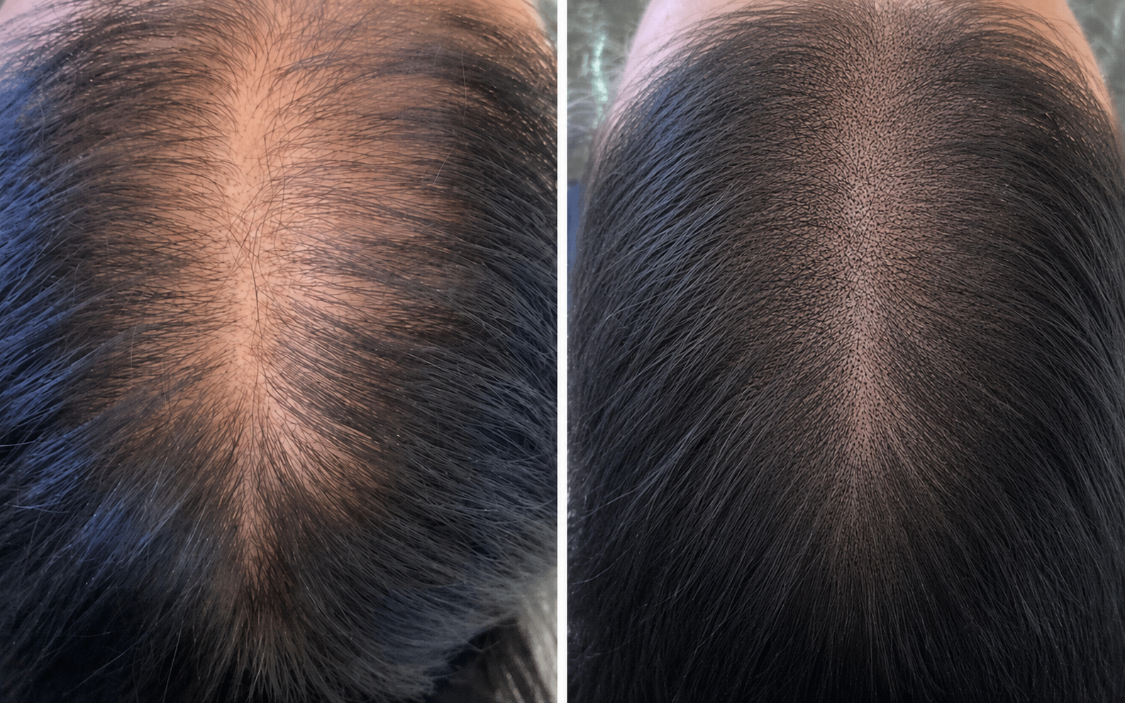 Female part line density
